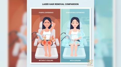 کولینگ لیزر چگونه از سوختگی پوست جلوگیری می‌کند؟ راهنمای علمی شاپرک