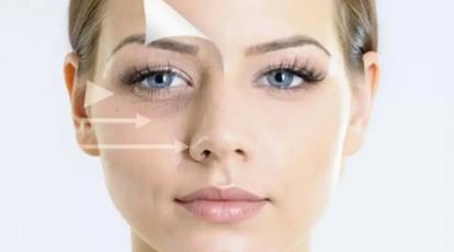 PRF یا مزوژل یانگ ای؟ | بهترین راهکار برای درمان چروک و سیاهی دور چشم در مشهد