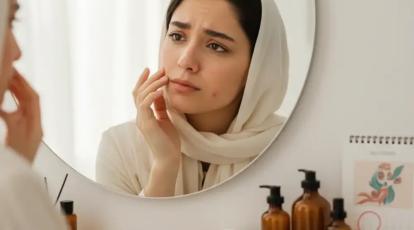 تغییرات پوست در قاعدگی و دوره‌ قبل از قاعدگی؛ از علت تا درمان تخصصی در شاپرک طلایی