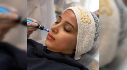 ترندهای زیبایی 2025: جدیدترین روش‌های لیفت و فرم‌دهی صورت در کلینیک شاپرک طلایی