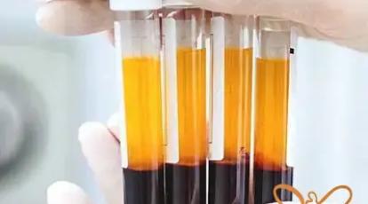 مزایای متعدد PRP مو در کلینیک تخصصی پوست و مو شاپرک طلایی مشهد 