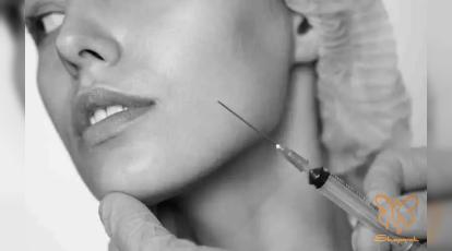 لیفت صورت بدون جراحی: مقایسه ۴ فیلر صورت محبوب در کلینیک شاپرک مشهد