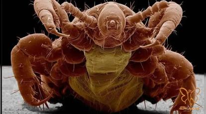 شپش یا کنه؟ تشخیص فوری مهمانان ناخوانده مو در کلینیک شاپرک مشهد