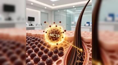 ژن MC1R: علت پوست روشن، کک و مک و آسیب‌ های پوستی