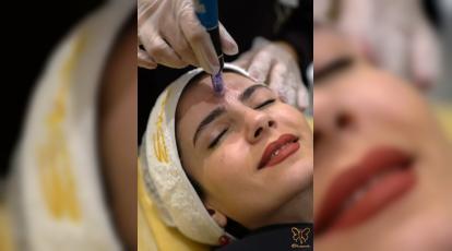  راهنمای جامع ترمیم پوست آسیب‌دیده در کلینیک شاپرک طلایی مشهد: از علائم تا درمان 