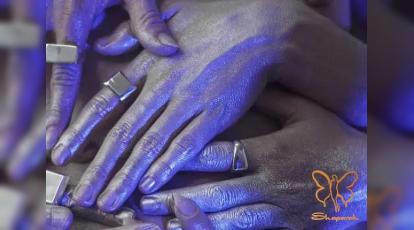 کلینیک شاپرک مشهد: آیا خدمات زیبایی برای بیماران آرگیریا ممکن است؟