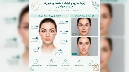 زاویه‌سازی و لیفت ۷ نقطه‌ای صورت بدون جراحی در مشهد + قیمت و عکس قبل و بعد