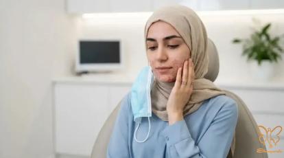 درمان قطعی ماسکنه ، جوش های ناخواسته ناشی از  استفاده طولانی مدت از ماسک صورت 