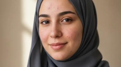 راهنمای کامل استفاده از کرم ترمیم کننده برای درمان جای جوش در مشهد