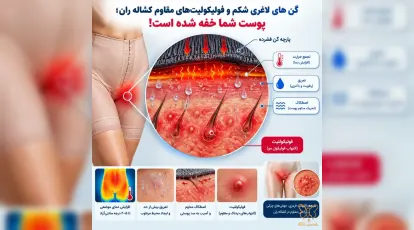 گن‌های لاغری شکم و فولیکولیت‌های مقاوم کشاله ران؛ پوست شما خفه شده است!