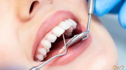 بوتاکس زدید؟ قبل از رفتن به دندانپزشکی این مطلب را بخوانید تا پشیمان نشوید!