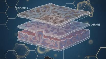 راهنمای کامل لیکن پلان پیلاریس (LPP): از علائم تا درمان و خدمات زیبایی مجاز