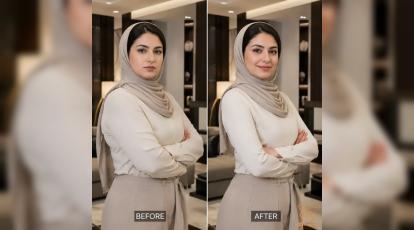 براکیوپلاستی چیست؟ آنچه باید درباره لیفت بازو در مشهد بدانید