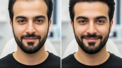توقف ریزش مو: راهنمای کامل درمان‌های تزریقی مو در شاپرک طلایی مشهد 