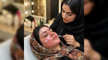 عوارض وحشتناک چسب اسپارتاک + بهترین درمان قطعی لک در مشهد 