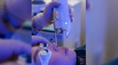 نهایت درخشش و جوانی؛ کشف تاثیر پاکسازی قبل و بعد از لیزر فوتونا و CO2 فرکشنال بر نتایج درمان