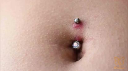 پیرسینگ ناف شما “گوشت اضافه” آورده؟ نگران نباشید! درمان قطعی اینجاست.