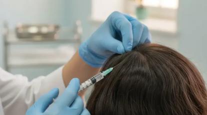 از عوارض مزوتراپی مو می‌ترسید؟ حقایقی برای داشتن موی پرپشت در مشهد 