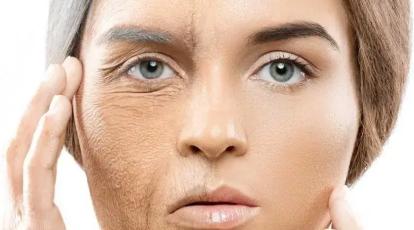تزریق چربی به صورت، جوانسازی طبیعی و ماندگار در مشهد 