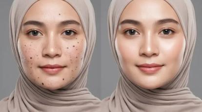 پوست شما می‌تواند دوباره متولد شود! راز جوانسازی با لیزر co2 فرکشنال در مشهد