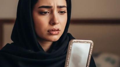 ۴ نشانه خطرناک بعد از تزریق فیلر که به تزریق فوری آنزیم در مشهد نیاز دارند