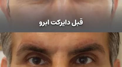 دایرکت ابرو راز چشمانی جذاب