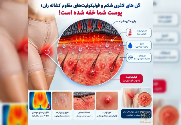 گن‌های لاغری شکم و فولیکولیت‌های مقاوم کشاله ران؛ پوست شما خفه شده است!