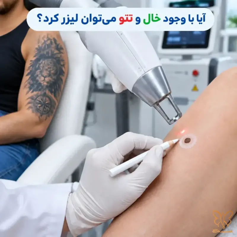 چرا رنگدانههای تتو و خال حساس هستند