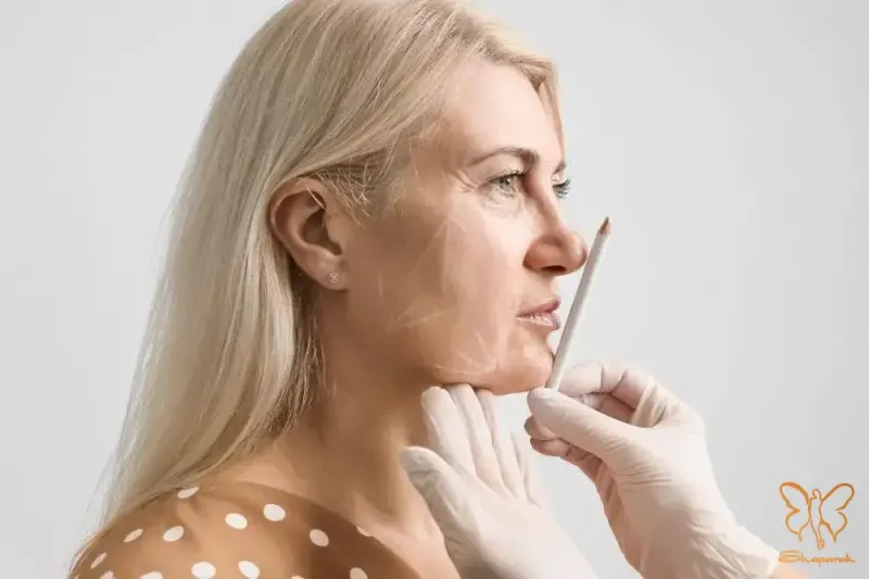 کاشت مو به روش FIT در مشهد بدون جراحی و بخیه با نتایج طبیعی مشهد