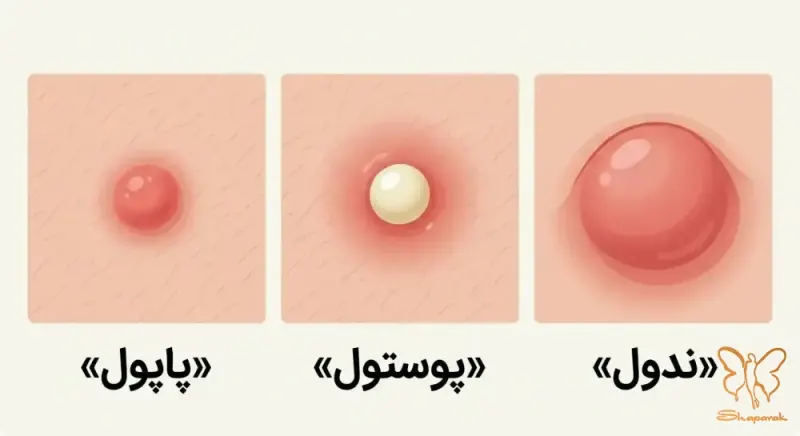  کلینیک تخصصی لیزر شاپرک طلایی مشهد