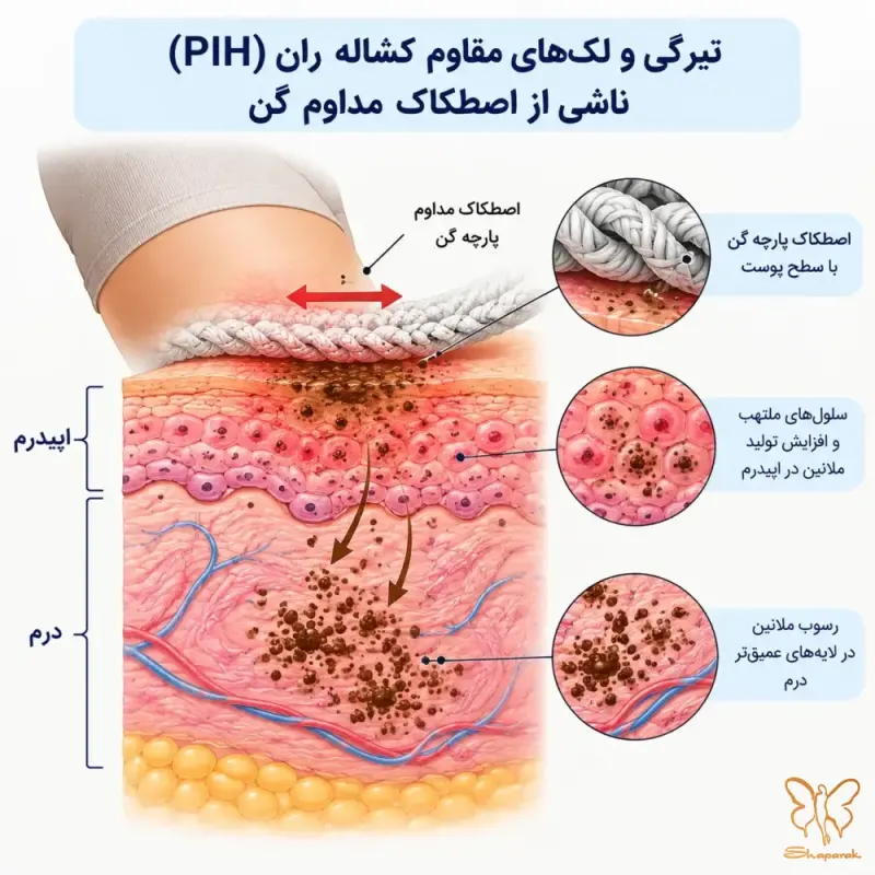 نقش تجمع ملانین در لایههای عمقی و راههای اصلاح تغییر رنگ اپیدرم نقش تجمع ملانین در لایههای عمقی و راههای اصلاح تغییر رنگ اپیدرم