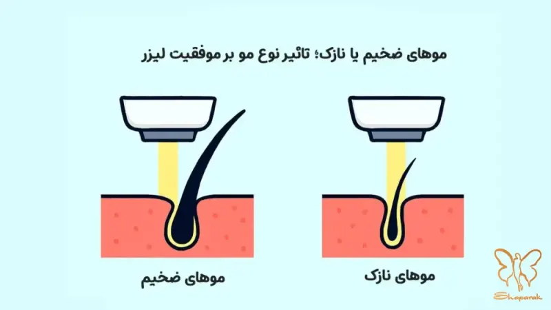 عوامل مؤثر بر ضخامت مو عوامل مؤثر بر ضخامت مو