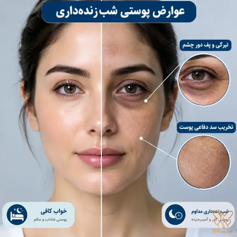 تیرگی دور چشم پفهای مقاوم و خطوط پنجهکلاغی زودرس