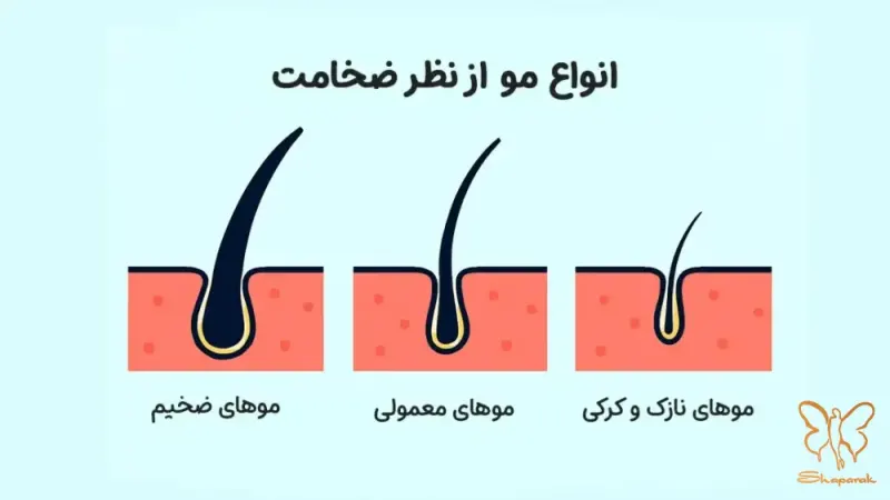 ۳ موهای نازک و کرکی ۳ موهای نازک و کرکی