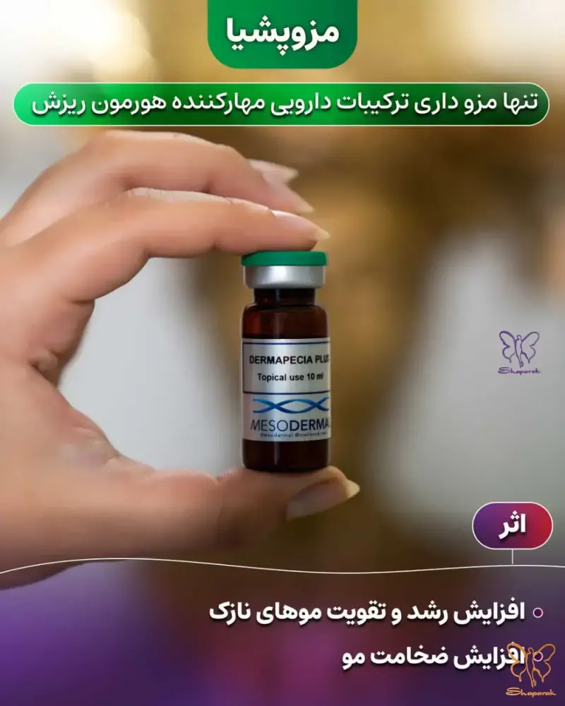 مزونیدلینگ سر مزونیدلینگ سر