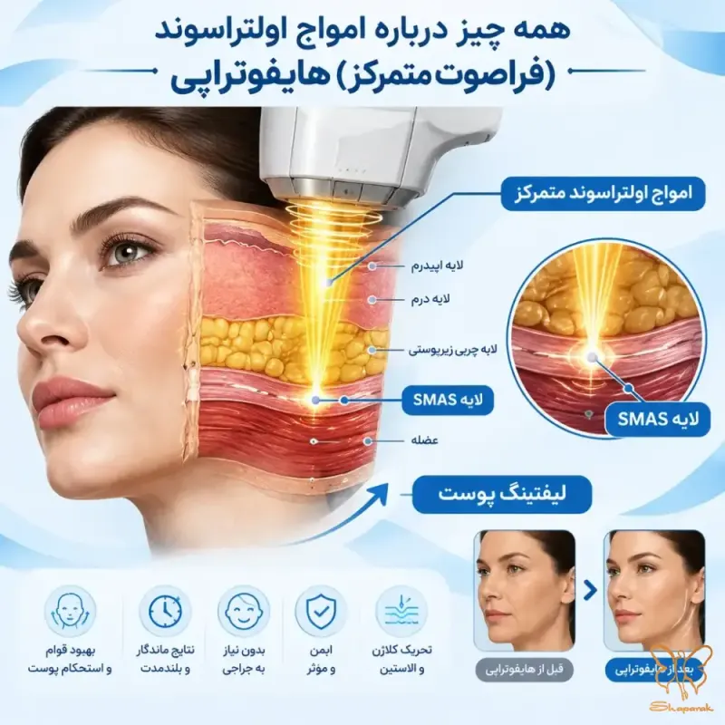 کلینیک تخصصی لیزر شاپرک طلایی مشهد کلینیک تخصصی لیزر شاپرک طلایی مشهد