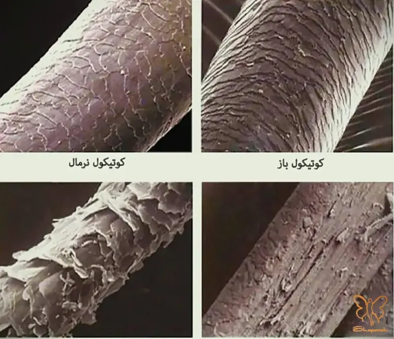 غلاف بیرونی ریشه مو غلاف بیرونی ریشه مو