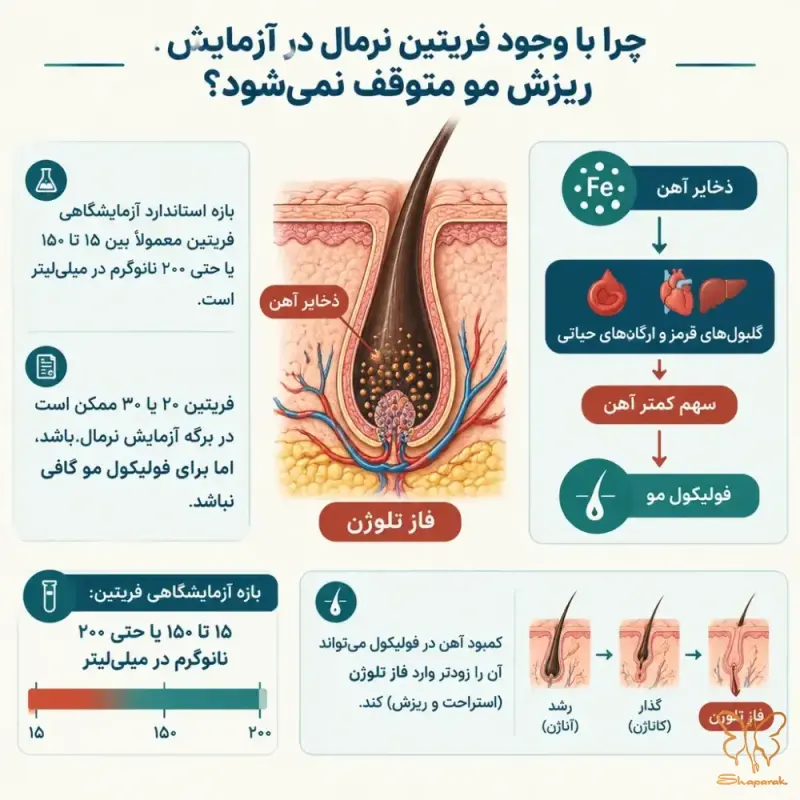 چرا با وجود فریتین نرمال در آزمایش ریزش مو متوقف نمیشود چرا با وجود فریتین نرمال در آزمایش ریزش مو متوقف نمیشود