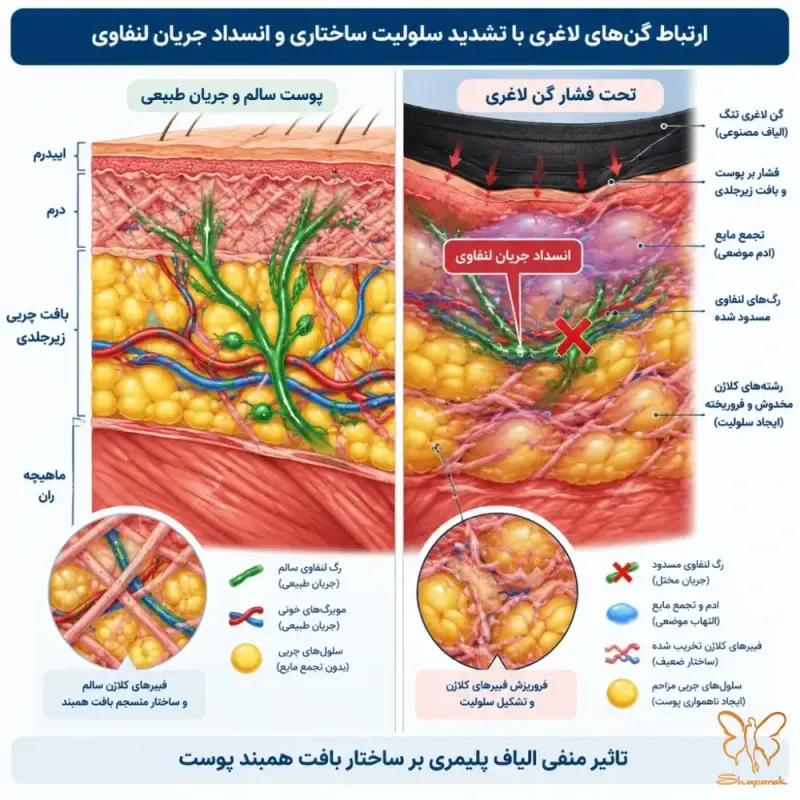 علائم بالینی فولیکولیت عمقی در برابر جوشهای معمولی پوست علائم بالینی فولیکولیت عمقی در برابر جوشهای معمولی پوست
