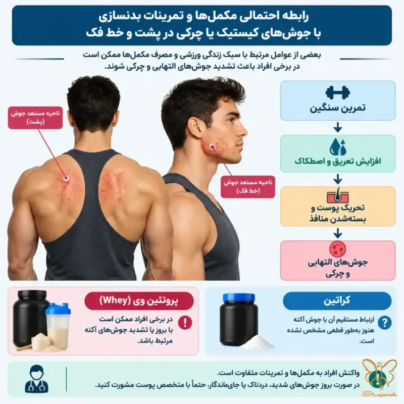 ریسک تبدیل کیستهای چرکی به اسکار هیپرتروفیک و کلوئید در قفسه سینه و کمر