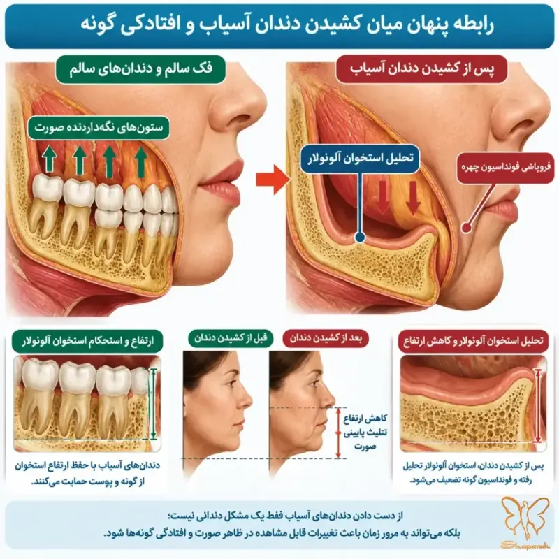 تأثیر تحلیل دندانهای آسیاب بر گودافتادگی شقیقه و تغییر زاویه فک پایین تأثیر تحلیل دندانهای آسیاب بر گودافتادگی شقیقه و تغییر زاویه فک پایین