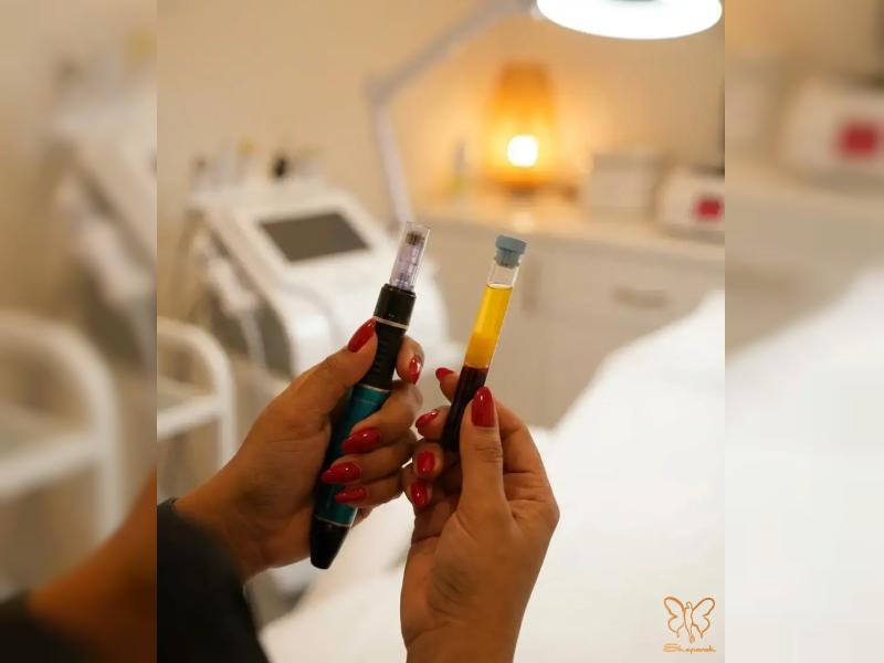  میکرونیدلینگ با پی آر پی (PRP) راز پوستی جوان و صاف 