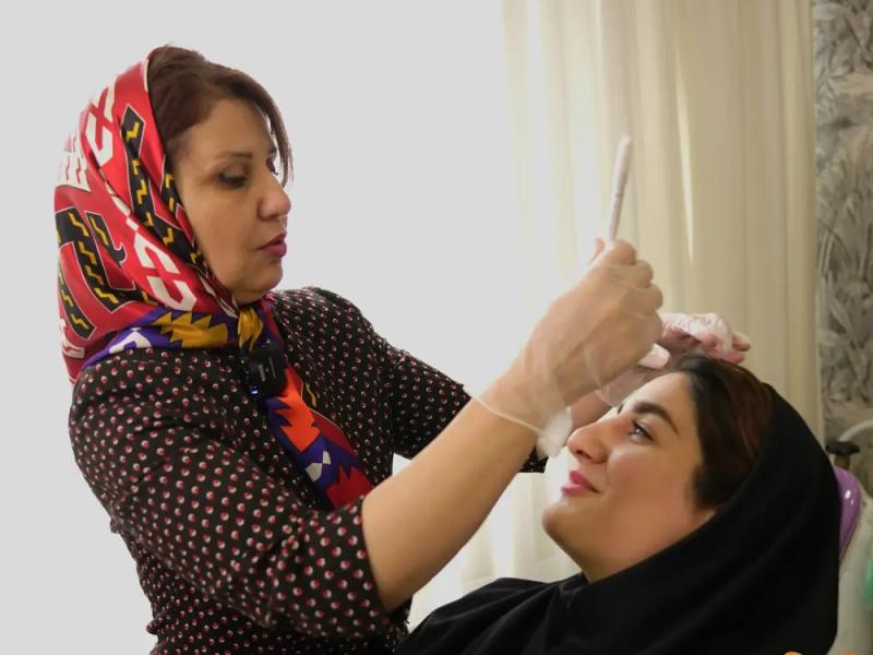  تزریق بوتاکس صورت و خداحافظی با چین و چروک صورت