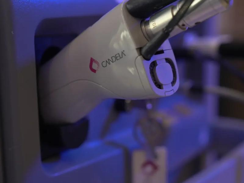 لیزر کندلا بهترین لیزر رفع مو زائد