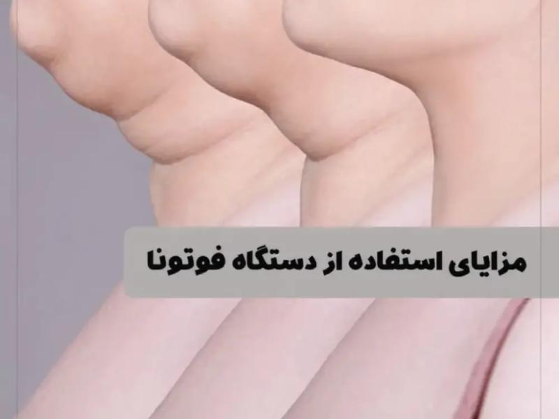 فوتونا لیپولیز غبغب با مزوتراپی چربی‌سوز در کلینیک شاپرک
