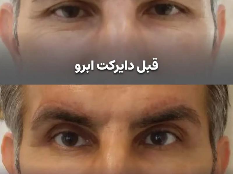 دایرکت ابرو راز چشمانی جذاب