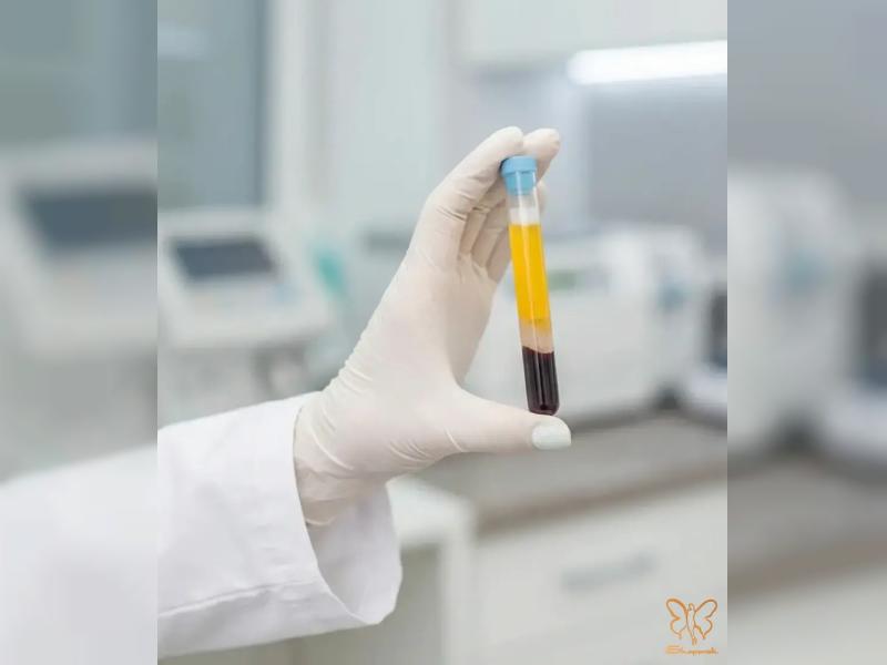 جوانسازی پوست با تزریق پی آر پی PRP صورت و زیر چشم