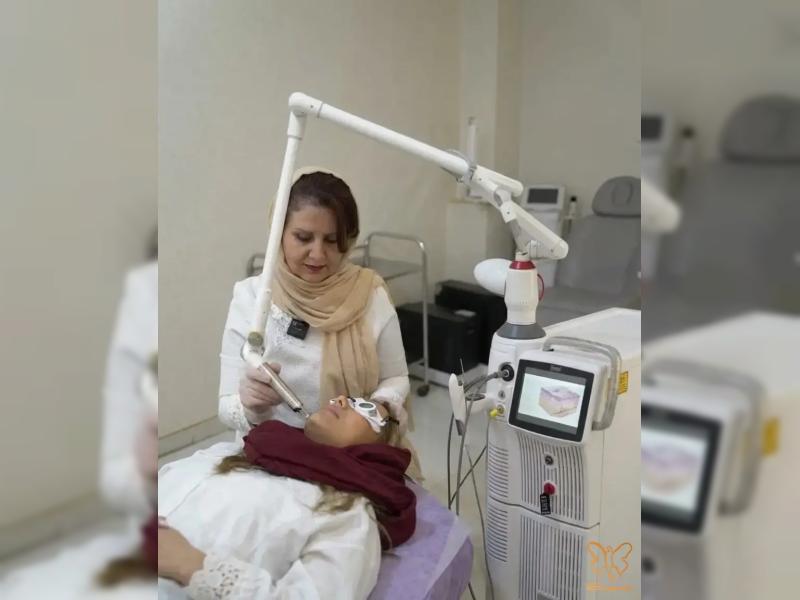 درمان لک، جای جوش و اسکار با لیزر فوتونا فرکشنال