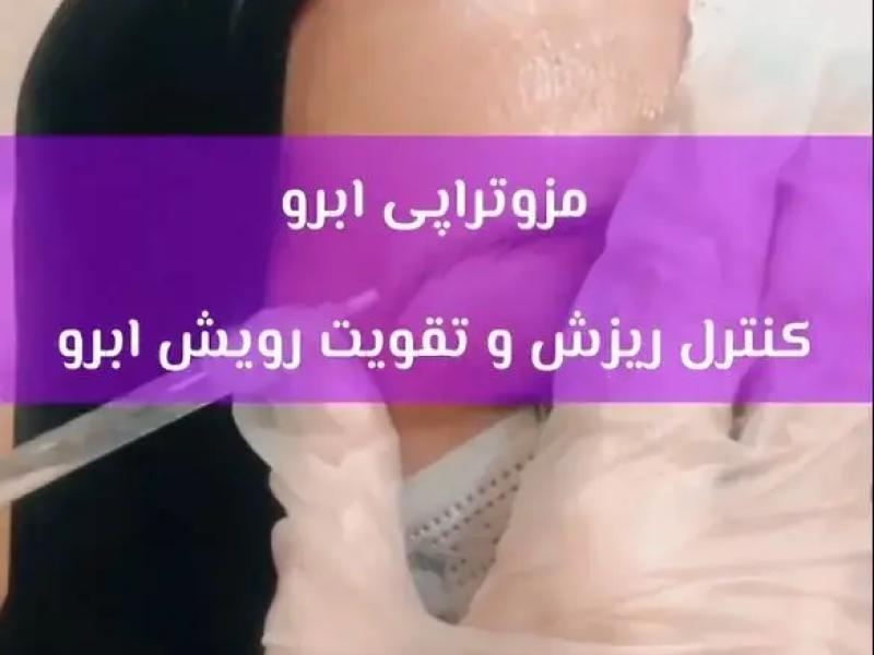 تقویت رشد ابروها با مزوتراپی ابرو