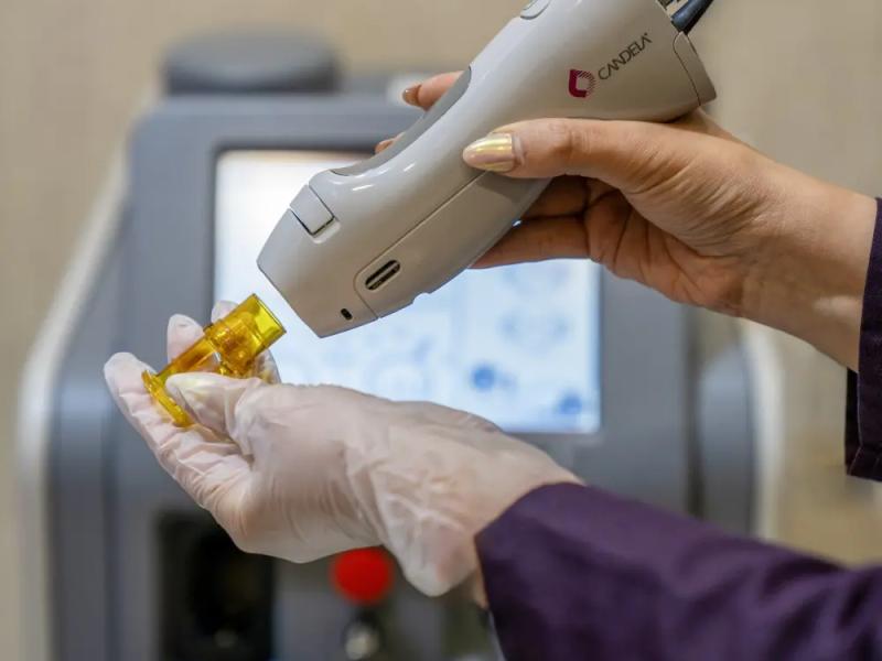 لیزر کندلا بهترین لیزر رفع مو زائد